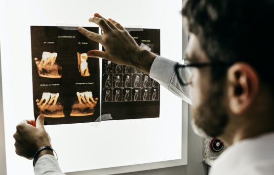 En tandläkare Eskilstuna i vit labbrock undersöker och håller upp tandröntgenbilder på en ljuslåda.