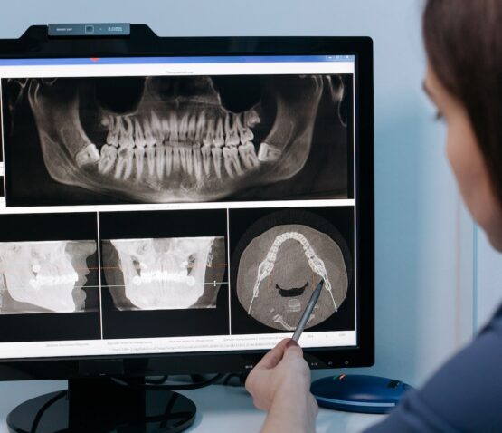 En person pekar på dentala röntgenbilder som visas på en datorskärm. Skärmen visar olika röntgenbilder av tänder och käke, vilket framhäver de avancerade tandreglerande Eskilstuna-tjänsterna som tillhandahålls av privata tandläkare Eskilstuna.